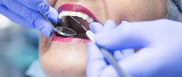 Best Urgent Tooth Repair  in Williamsport, OH